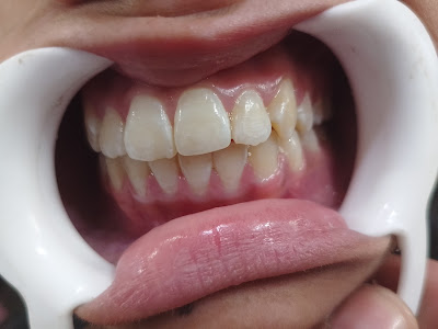 Aezal Dental Clinic Karachi Gallery