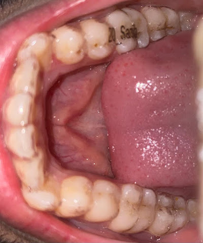 Smile Transformation Karachi