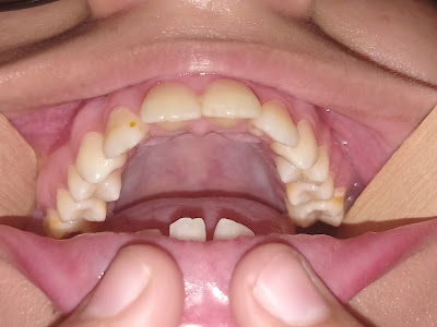 Smile Transformation Karachi