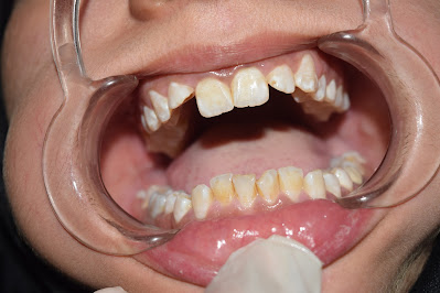 Aezal Dental Clinic Karachi Gallery