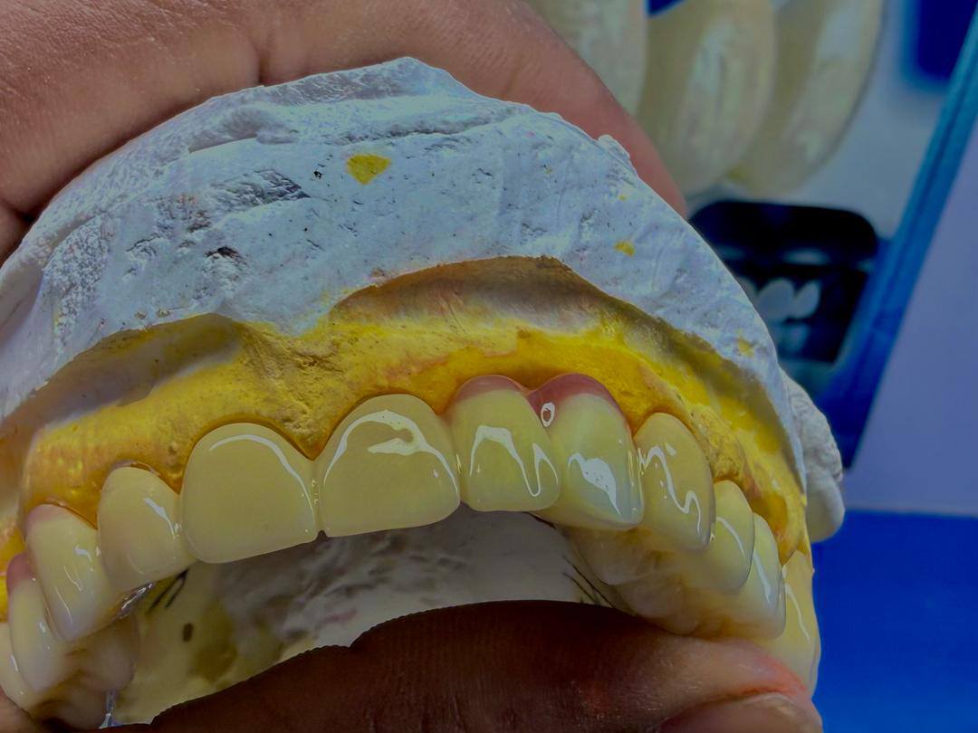 Smile Transformation Karachi