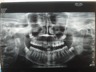 Smile Transformation Karachi