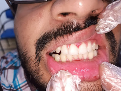 Aezal Dental Clinic Karachi Gallery