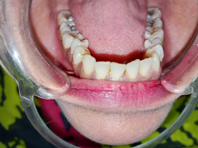 Smile Transformation Karachi