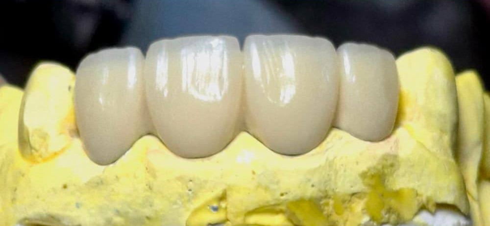 Best Dentist in Karachi